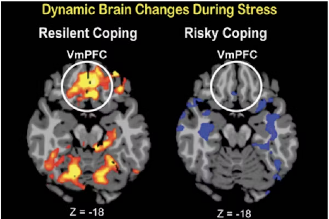 ¿Cómo responde nuestro cerebro a la incertidumbre ?